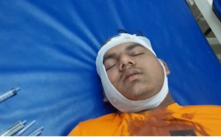 भाई बहन से मारपीट करने वाले सांसद प्रतिनिधि पर पुलिस ने मामला किया दर्ज, लड़की के प्राइवेट पार्ट में गंभीर चोट, भाई