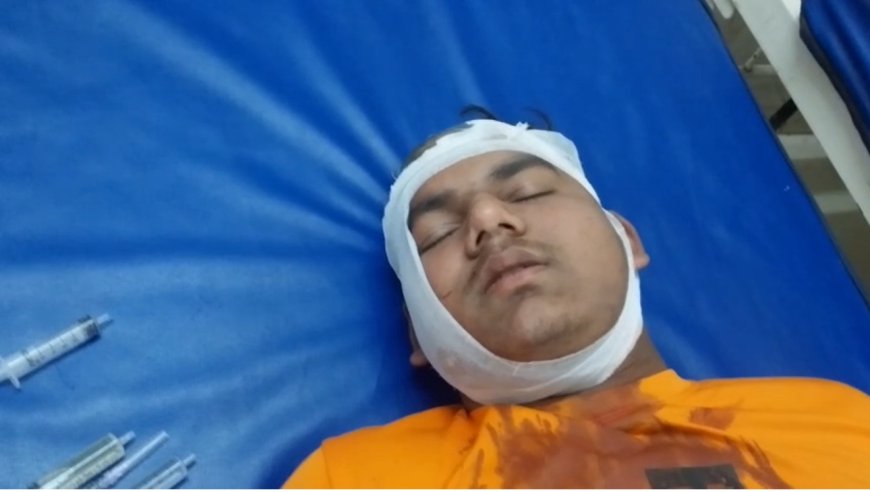 भाई बहन से मारपीट करने वाले सांसद प्रतिनिधि पर पुलिस ने मामला किया दर्ज, लड़की के प्राइवेट पार्ट में गंभीर चोट, भाई