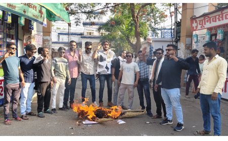 CHMO डॉक्टर दिनेश देहल वार मुर्दा बाद के साथ जलाया पुतला